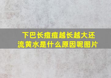 下巴长痘痘越长越大还流黄水是什么原因呢图片