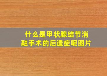 什么是甲状腺结节消融手术的后遗症呢图片