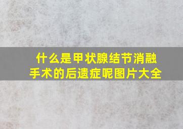 什么是甲状腺结节消融手术的后遗症呢图片大全