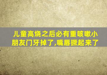 儿童高烧之后必有重咳嗽小朋友门牙掉了,嘴唇撅起来了