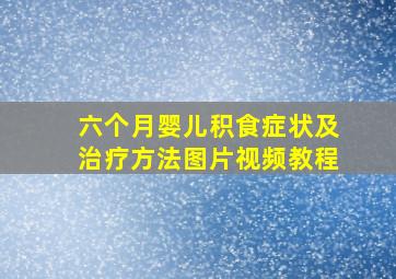 六个月婴儿积食症状及治疗方法图片视频教程