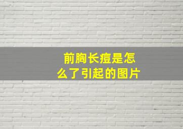 前胸长痘是怎么了引起的图片