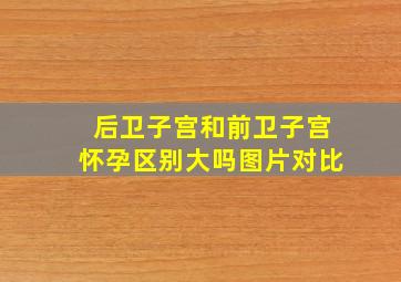 后卫子宫和前卫子宫怀孕区别大吗图片对比