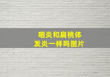 咽炎和扁桃体发炎一样吗图片