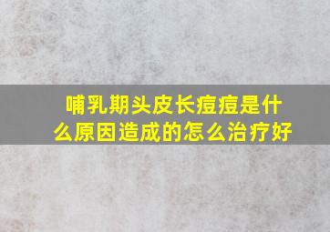 哺乳期头皮长痘痘是什么原因造成的怎么治疗好