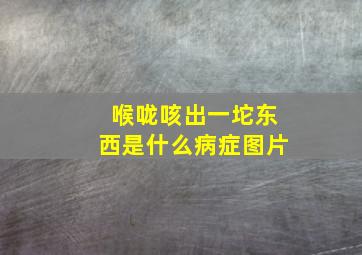 喉咙咳出一坨东西是什么病症图片