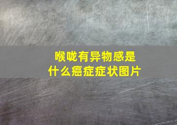 喉咙有异物感是什么癌症症状图片