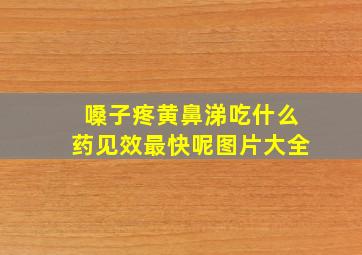 嗓子疼黄鼻涕吃什么药见效最快呢图片大全