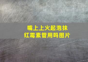 嘴上上火起泡抹红霉素管用吗图片