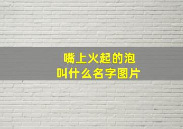 嘴上火起的泡叫什么名字图片