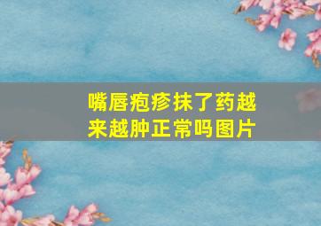 嘴唇疱疹抹了药越来越肿正常吗图片