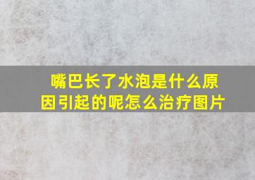 嘴巴长了水泡是什么原因引起的呢怎么治疗图片