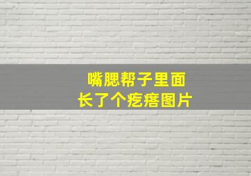 嘴腮帮子里面长了个疙瘩图片