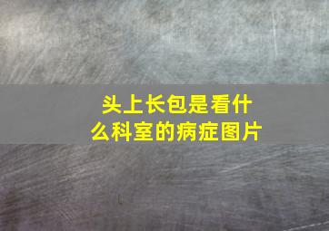 头上长包是看什么科室的病症图片