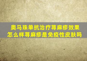 奥马珠单抗治疗荨麻疹效果怎么样荨麻疹是免疫性皮肤吗