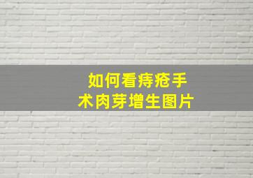 如何看痔疮手术肉芽增生图片