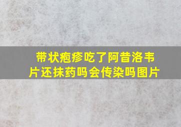 带状疱疹吃了阿昔洛韦片还抹药吗会传染吗图片