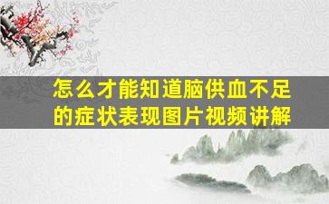 怎么才能知道脑供血不足的症状表现图片视频讲解