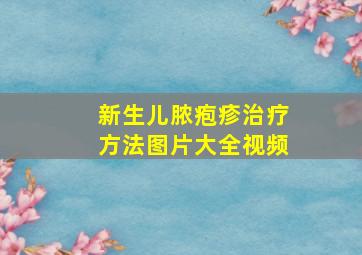 新生儿脓疱疹治疗方法图片大全视频