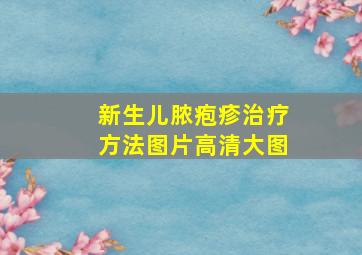 新生儿脓疱疹治疗方法图片高清大图