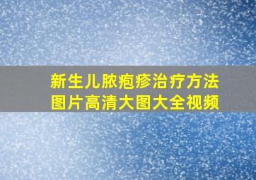 新生儿脓疱疹治疗方法图片高清大图大全视频