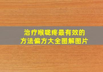 治疗喉咙疼最有效的方法偏方大全图解图片