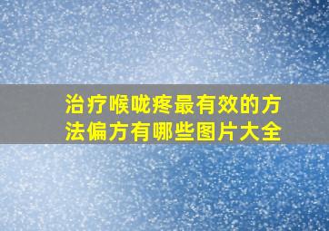 治疗喉咙疼最有效的方法偏方有哪些图片大全