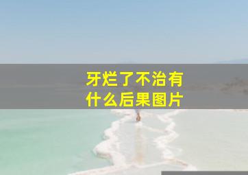 牙烂了不治有什么后果图片