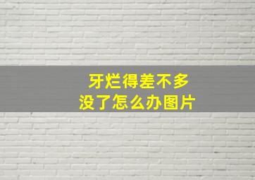 牙烂得差不多没了怎么办图片