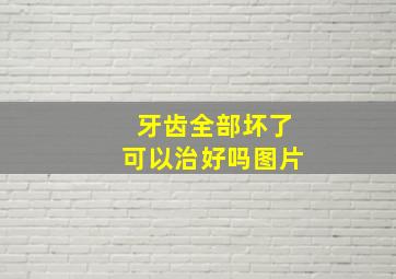 牙齿全部坏了可以治好吗图片