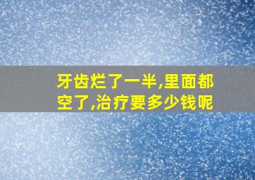 牙齿烂了一半,里面都空了,治疗要多少钱呢