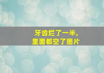 牙齿烂了一半,里面都空了图片