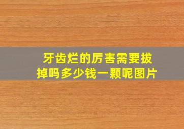 牙齿烂的厉害需要拔掉吗多少钱一颗呢图片