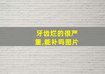 牙齿烂的很严重,能补吗图片