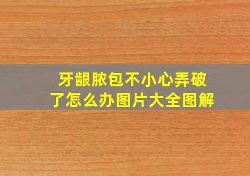 牙龈脓包不小心弄破了怎么办图片大全图解