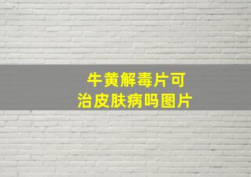 牛黄解毒片可治皮肤病吗图片