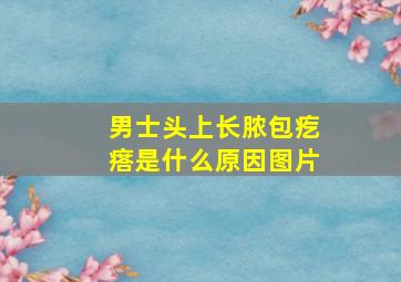 男士头上长脓包疙瘩是什么原因图片