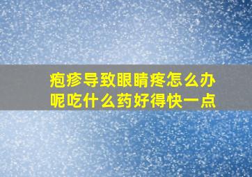 疱疹导致眼睛疼怎么办呢吃什么药好得快一点