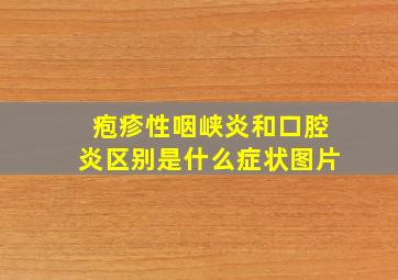 疱疹性咽峡炎和口腔炎区别是什么症状图片