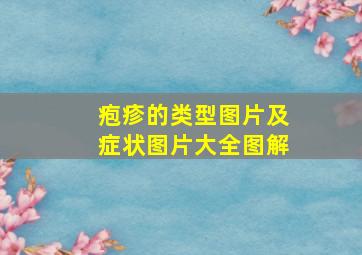 疱疹的类型图片及症状图片大全图解