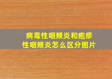 病毒性咽颊炎和疱疹性咽颊炎怎么区分图片