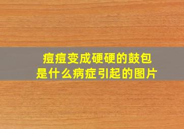 痘痘变成硬硬的鼓包是什么病症引起的图片