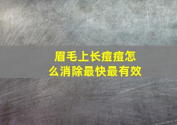 眉毛上长痘痘怎么消除最快最有效