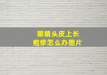 眼睛头皮上长疱疹怎么办图片