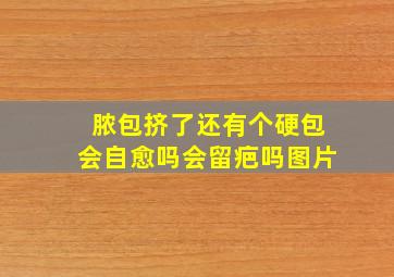 脓包挤了还有个硬包会自愈吗会留疤吗图片