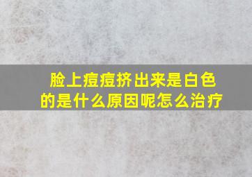 脸上痘痘挤出来是白色的是什么原因呢怎么治疗