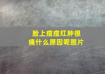 脸上痘痘红肿很痛什么原因呢图片