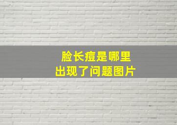 脸长痘是哪里出现了问题图片