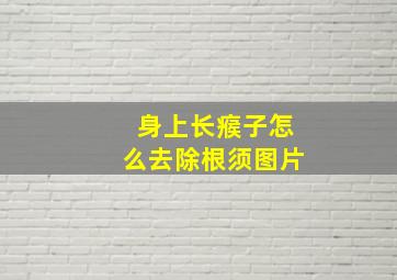 身上长瘊子怎么去除根须图片