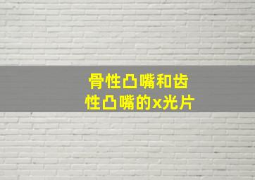 骨性凸嘴和齿性凸嘴的x光片